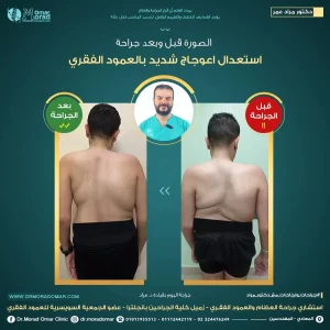 افضل دكتور عظام و عمود فقري - دكتور مراد عمر