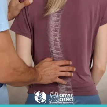 درجات اعوجاج العمود الفقري: فهم شامل للمشكلة وكيفية التعامل معها