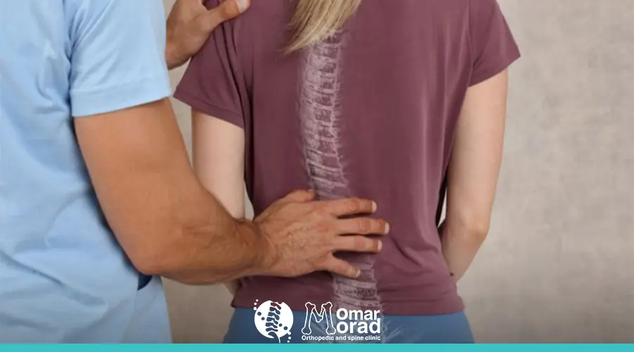 درجات اعوجاج العمود الفقري​: فهم شامل للمشكلة وكيفية التعامل معها