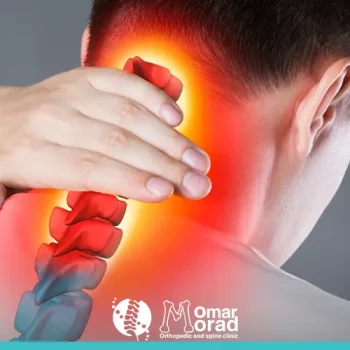 عملية غضروف الرقبة بالمنظار: الحل الحديث للتخلص من الألم والتعافي السريع
