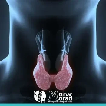 ما هو غضروف الرقبة ؟ كل ماتود أن تعرفه والأسباب والعلاج