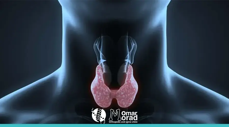 ما هو غضروف الرقبة​ ؟ كل ماتود أن تعرفه والأسباب والعلاج