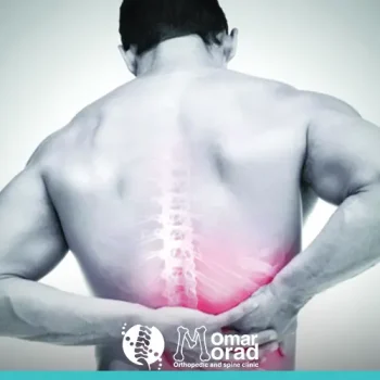 نسبة نجاح عمليات العمود الفقري