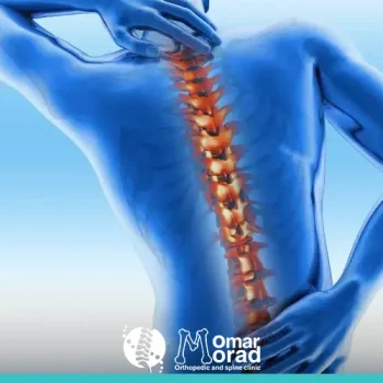 أنواع فقرات العمود الفقري