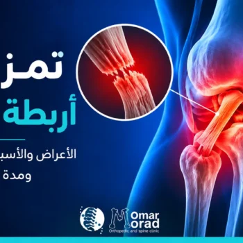 تمزق اربطة الركبة: الأعراض والأسباب وطرق العلاج ومدة الشفاء