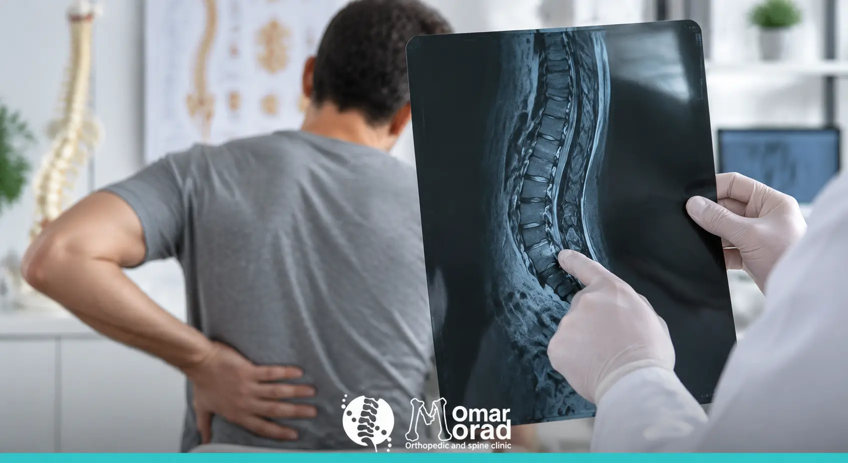 أعراض ورم العمود الفقري والعلامات المبكرة التي تستدعي الفحص