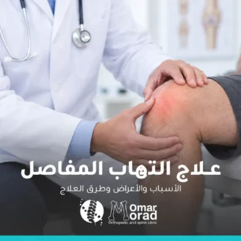 علاج التهاب المفاصل: الخيارات الطبية والطبيعية ومتى تحتاج طبيبًا؟